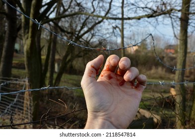 the thief grabbed the newly stretched barbed wire and bled from his hand. Another attempt to get behind the fence on private land will change your mind. self-harm is a serious illness