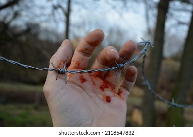 the thief grabbed the newly stretched barbed wire and bled from his hand. Another attempt to get behind the fence on private land will change your mind. self-harm is a serious illness