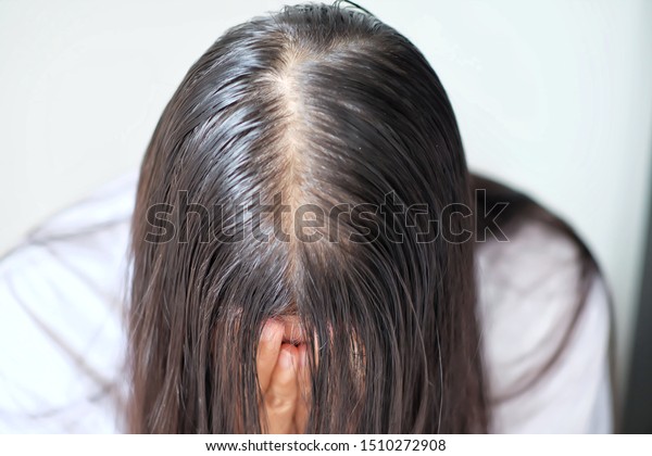 Thin Hair Problems That Make Women Royalty Free Stock Image