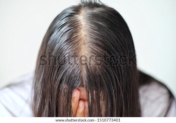 Thin Hair Problems That Make Women Stock Photo Edit Now 1510773401