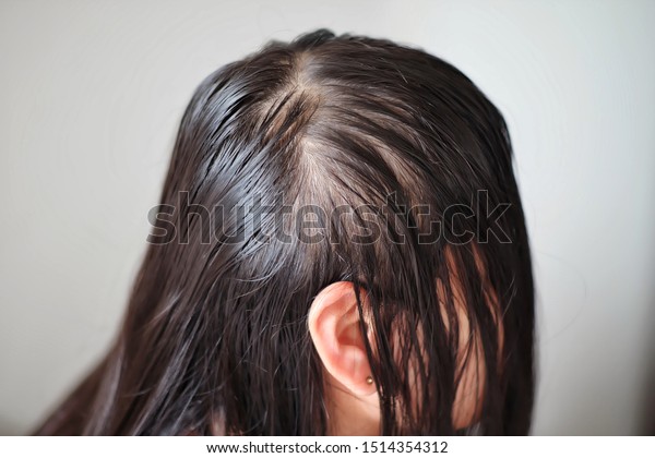 Thin Hair Problems That Make Women Stock Photo Edit Now 1514354312