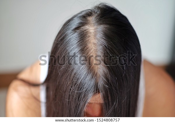 Thin Hair Problems That Make Women Stock Photo Edit Now 1524808757