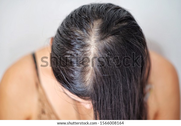 Thin Hair Problems That Make Women Stock Photo Edit Now 1566008164