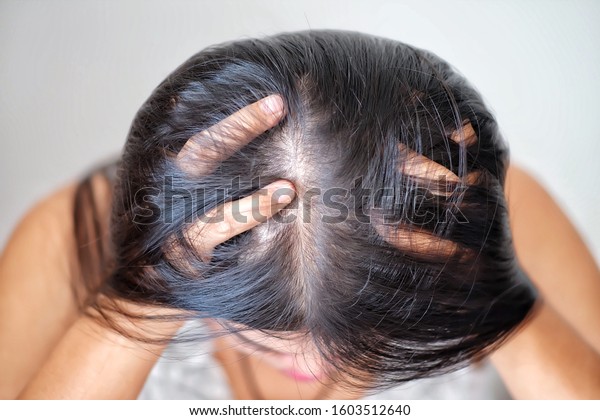 Thin Hair Problems That Make Women Stock Photo Edit Now 1603512640
