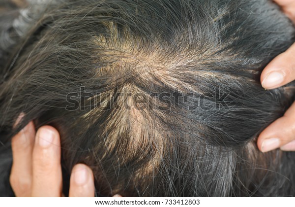 Thin Hair Women Stock Photo Edit Now 733412803