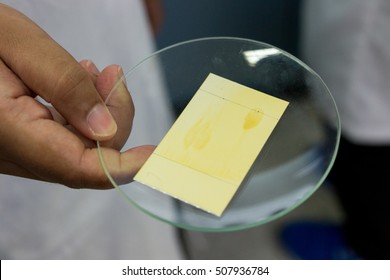 Thin layer chromatography is used to separate components 