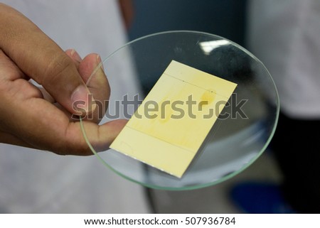 Thin layer chromatography is used to separate components 