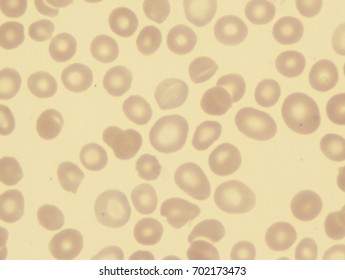 Thin Macrocyte Leptocyte Stock Photo 702173473 | Shutterstock