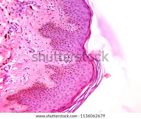 Thin skin epidermis stained with hematoxylin and eosin showing abundant melanin pigment in the basal and spinous layers. The pigmented cells are both melanocytes and keratinocytes. 
