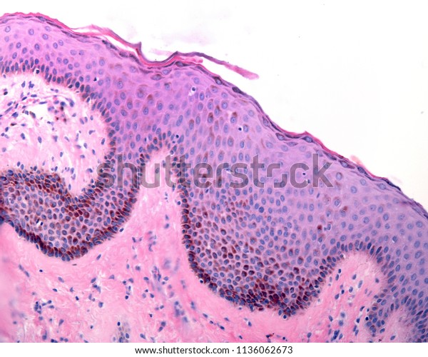 Thin Skin Epidermis Stained Hematoxylin Eosin Stock Photo 1136062673 ...