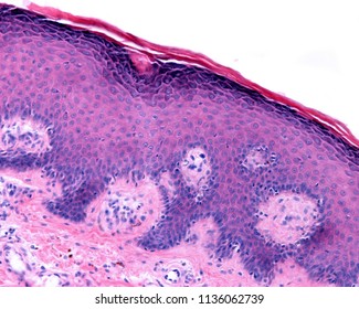 Thin skin showing the epidermis with its different strata, resting on the papillary dermis.