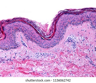 Thin skin showing the epidermis with its different strata, resting on the dermis.