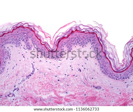 Thin skin showing the epidermis with their different layers resting on dermis.