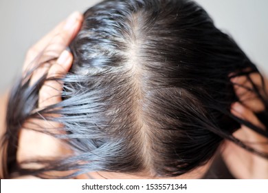 Royalty Free Thinning Hair Stock Images Photos Vectors