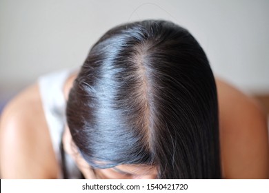 Thinning Scalp Woman Images Stock Photos Vectors Shutterstock