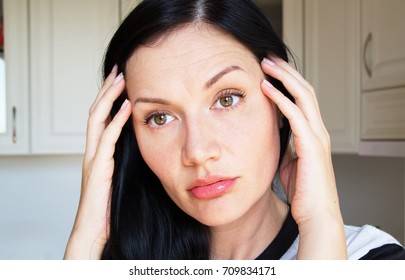 A Thirty-year-old Woman With Wrinkles On Her Forehead