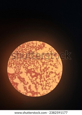 This is Ascomycota- Saccharomyces, zoom 7×40