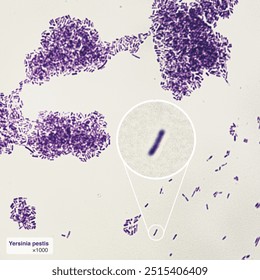 This is the bacillus pestis, the pathogen that caused the Black Death in Europe.Magnify 1000x