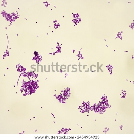 This is the bacillus pestis, the pathogen that caused the Black Death in Europe.Magnify 1000x