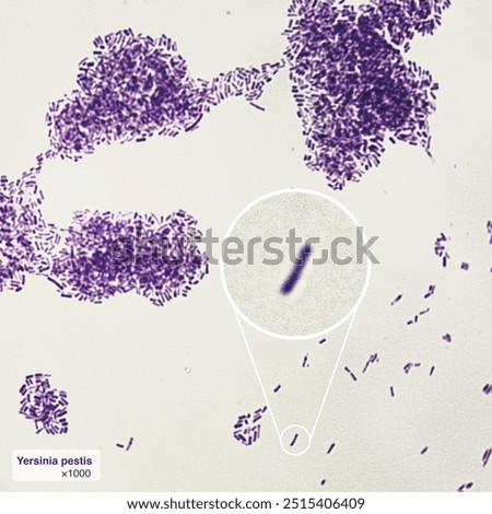 This is the bacillus pestis, the pathogen that caused the Black Death in Europe.Magnify 1000x
