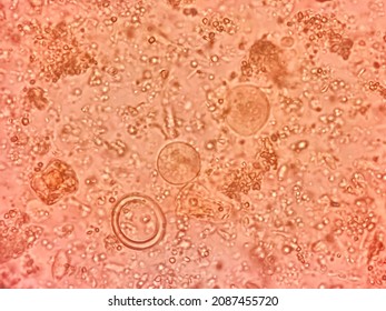 This is entamoeba coli cyst by microscopic 40x. Stock Photo