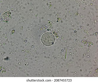 This is entamoeba coli cyst by microscopic 40x. Stock Photo