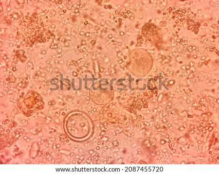 This is entamoeba coli cyst by microscopic 40x.