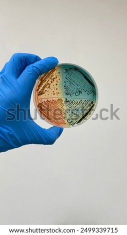 This high-resolution image features a possible Salmonella culture on Bismuth Sulfite Agar (BSA) in a petri dish, held by a gloved hand. Ideal for scientific, educational, and microbiological projects.