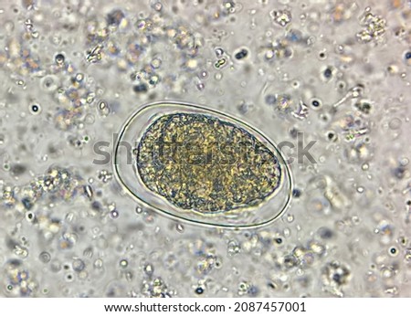 This is hookworm parasite egg by microscopic 40x.