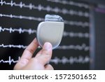 This image demonstrates Implantable cardioverter defibrillator (ICDs) on hands