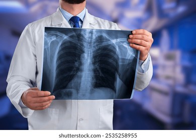 This image shows a doctor holding an X-ray image of a patient's chest. The X-ray displays the ribcage, spine, and parts of the lungs, while the doctor is dressed in professional attire. - Powered by Shutterstock