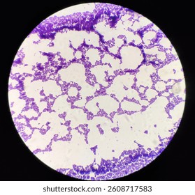 This image shows a microscopic view of Lactobacillus sp. stained using the Gram staining technique. They are stained purple, indicating that they are Gram-positive