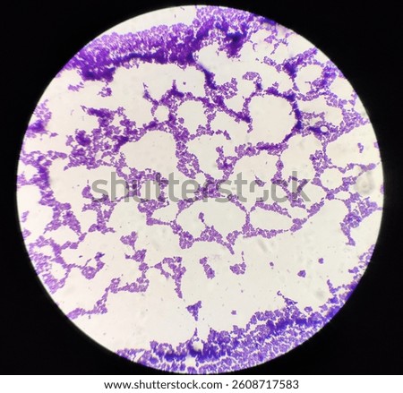 This image shows a microscopic view of Lactobacillus sp. stained using the Gram staining technique. They are stained purple, indicating that they are Gram-positive