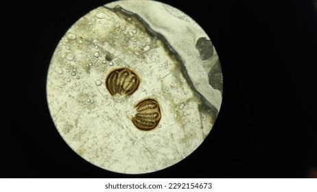 This image shows the posterior section of phormia spp. larvae. this examination is carried out when there is an autopsy to find out how long the creature has been dead - parasitology