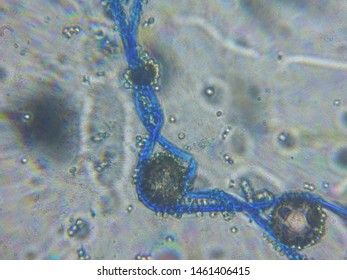 
this is a microscope display of corn mushrooms