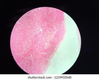 This Picture Show Endocardium Of Ventricle 