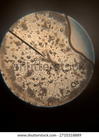 This is a plant stem under a microscope, with vascular bundles scattered among large parenchyma cells. 