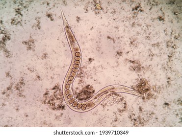 83 Strongyloides Stercoralis Larvae Images, Stock Photos & Vectors ...