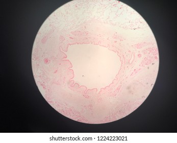 
This Is Trachea Cross Section Histology Which Consist Of Tracheal Cartilage ,submucosa ,lamina Propria ,and Respiratory Epithelium 