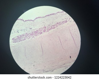 
This Is Trachea Cross Section Histology Which Consist Of Tracheal Cartilage ,submucosa ,lamina Propria ,and Respiratory Epithelium 