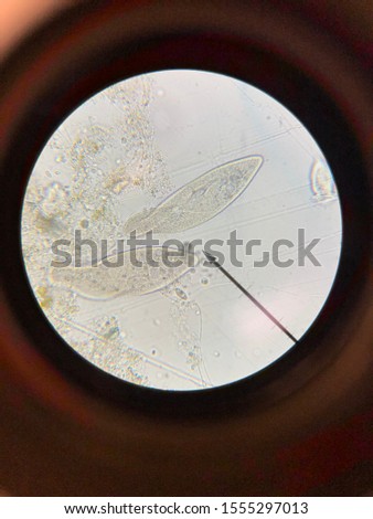 This is two paramecium under a microscope.