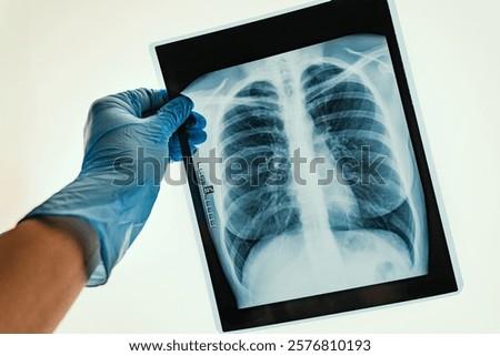 This Xray image shows the complex structure of human lungs, useful for accurate diagnosis and evaluation
