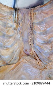 Thoracic Wall (internal View) Demonstrated The Internal Thoracic Vessels And Related Structures. Gross Anatomy Lab Cadaver.