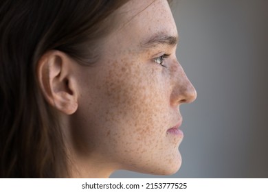 Thoughtful Freckled Teenage Girl Facial Close Up Side Portrait. Pretty Young Model Woman Clean Face With Fresh Clean Spotted Skin Looking Away, Thinking. Natural Beauty, Skincare, Cosmetology Concept