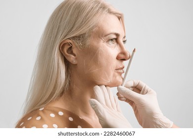 Thread facelift, concept of lifting skin. Procedure facial contouring using mesothreads. A beautician in gloves makes markings with a white pencil on a woman's face for the introduction of fillers - Powered by Shutterstock