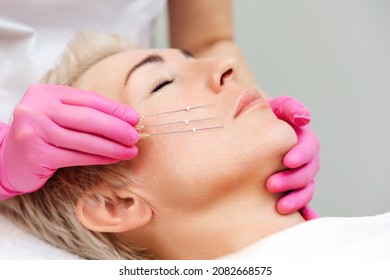 Thread lifting procediure. Professional cosmetologist in pink medical gloves holding needles near cheek. Close up face of adult pretty woman.