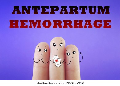 Three Fingers Decorated As Three Girls. They Are Worrying About Menstrual Problems. Suitable To Be Used For Anything About Antepartum Hemorrhage.