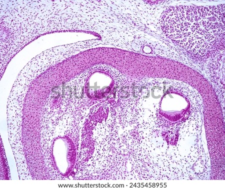 Three sections of a developing cochlea showing the epithelial thickening that will be the organ of Corti and the spiral ganglion. The bony labyrinth of temporal bone is still in cartilaginous stage