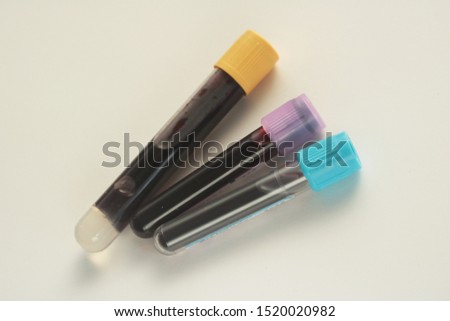 three small tubes of blood sample 