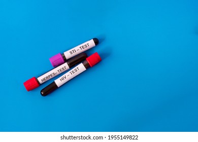 Three Tubes Of Blood For Testing For Sexually Transmitted Diseases Isolated On A Blue Background. Testing For HIV, Herpes, Sti. Aids Prevention Concept